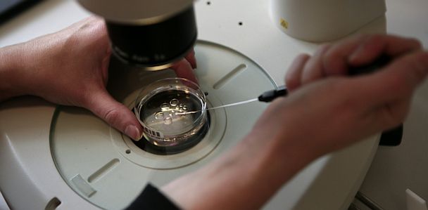 Assisted Hatching IVF India