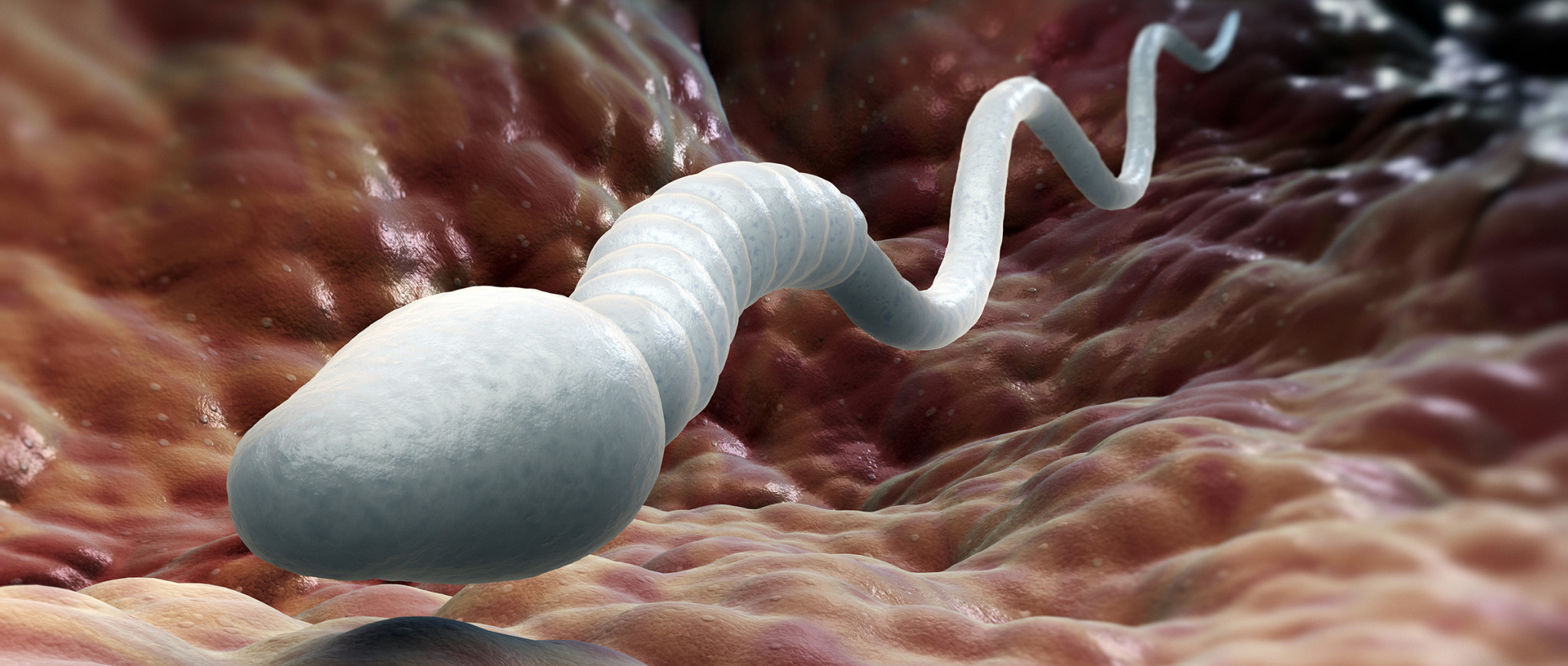 Azoospermia Treatment in India