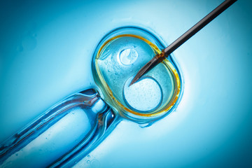 ivf