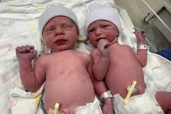 Twins from Embryos Frozen