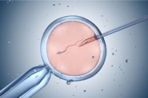 In Vitro Fertilization in Kenya
