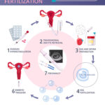 IVF Clinics in Pakistan