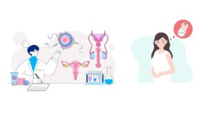 Causes Of IVF Success Rate In India