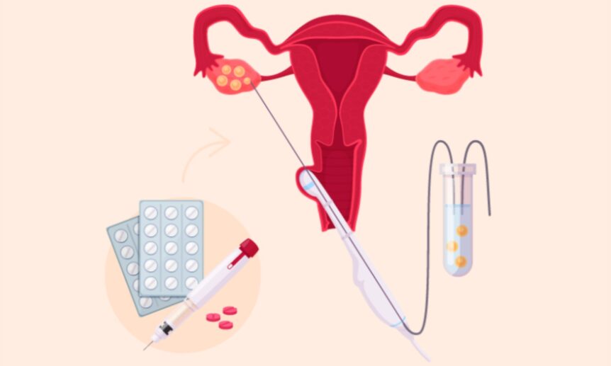 Donor Eggs For IVF In India
