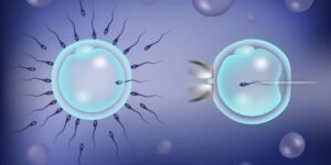 Egg Or Sperm In Kazakhstan For Fertility Treatment