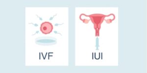 IUI Or IVF In India