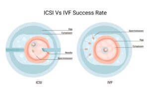  ICSI Vs IVF Success Rate
