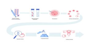 Steps Of IVF Treatment In Nepal