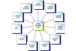 Causes Of Male Infertility