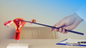 Cost Of Fallopian Tube Infertility Treatment