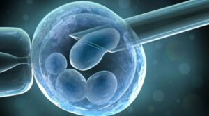 Egg Donor Cost In Iran