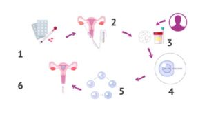 Cost Of IVF In Ethiopia