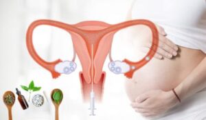 Reproductive Remedies In Ethiopia