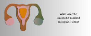 Symptoms Of Blocked Fallopian Tubes