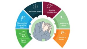 Causes Of Male Infertility In India