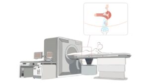 Fibroid Removal In The Uterus Wall