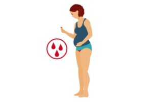 Miscarriage Damping For A Woman