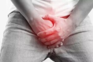 Causes Of Varicocele