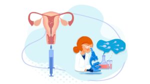 IUI Treatment In Noida